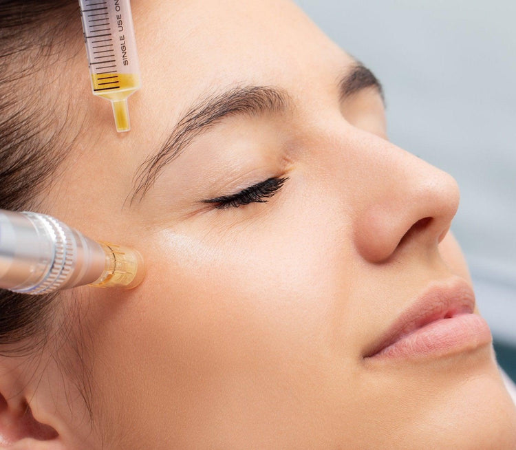 Platelet Rich Plasma (Face)