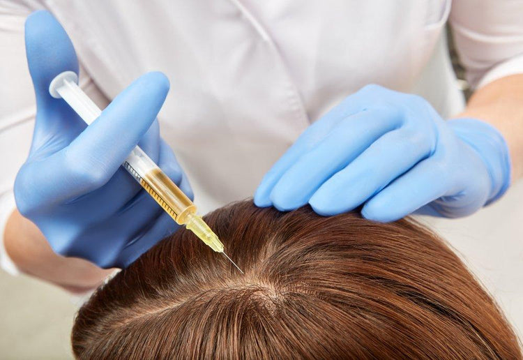Scalp PRP for Hair Restoration