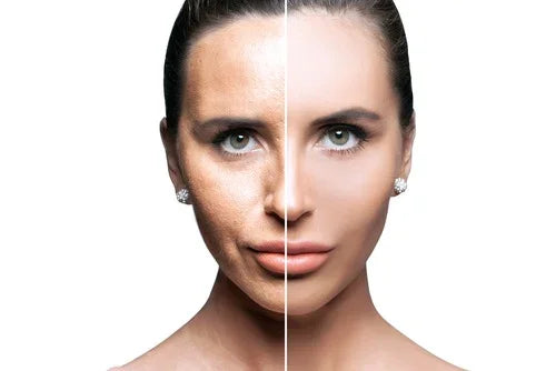 Understanding Menopausal Skin
